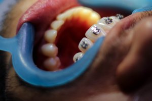 Ortodontia- noções básicas